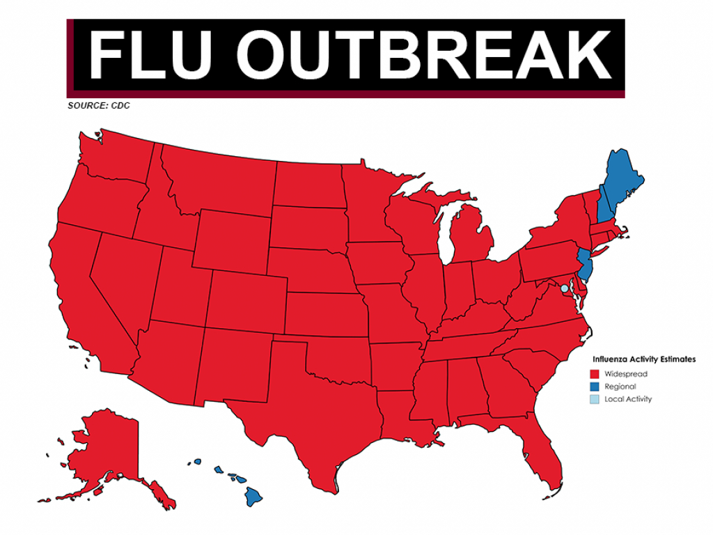 Florida Among 46 States With Widespread Flu Outbreaks in Washington State Flu Map